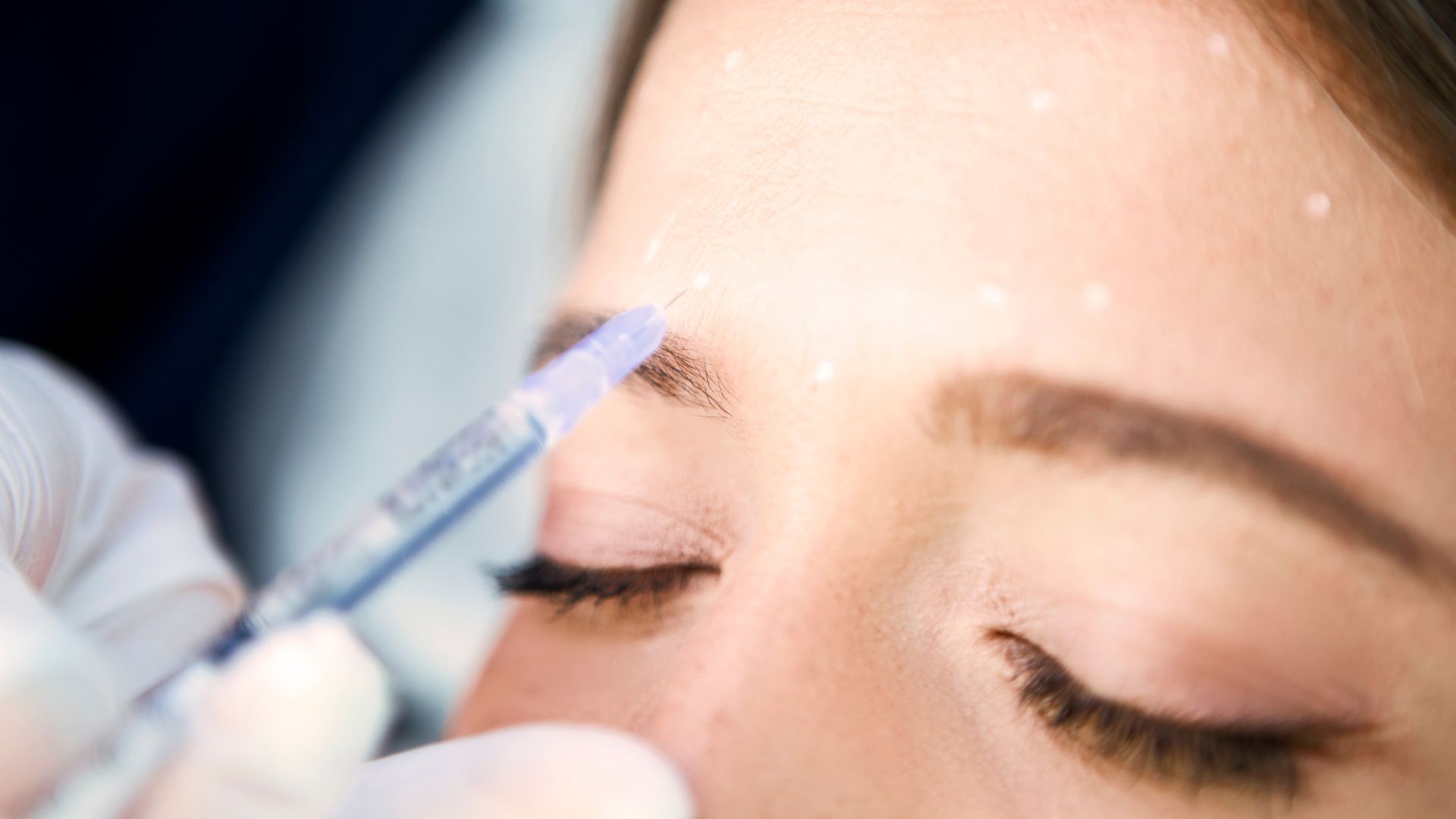 Injection de Botox à la Clinique Clemenceau Arras