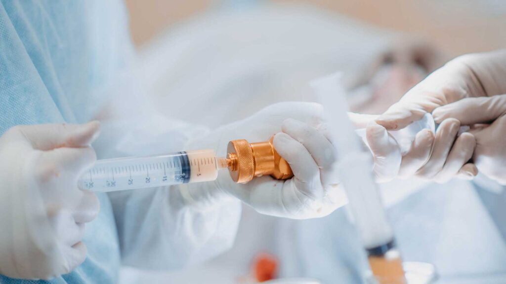 Tout savoir sur le lipofilling mammaire